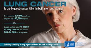 What does lung cancer mean? Lung Cancer Is The Biggest Cancer Killer In Both Men And Women Cdc