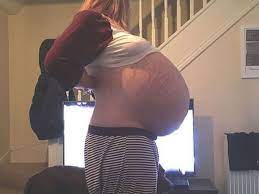 Zwei Jahre schwanger? Was im Bauch dieser Frau wächst, wiegt unglaubliche  26 Kilo