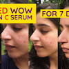 You need to read this before you buy a vitamin c supplement. 1