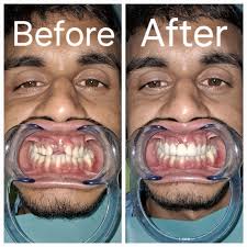 Dental Laboratory in Gaya