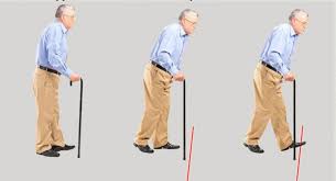 Find deals on products in camping & hiking on amazon. Chalte Raho Parkinson S Patients Walking Stick Enabled In