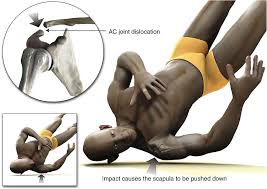 Image result for Fall on Shoulder