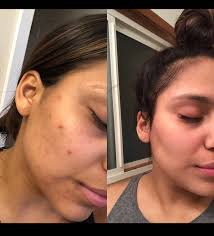 Ciara Palmer (@ciarapalmeresthetics) • Instagram photos and videos