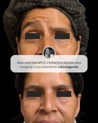 DRA. ANA KARLA (@draanakarla.smartlipo) • Instagram photos and videos