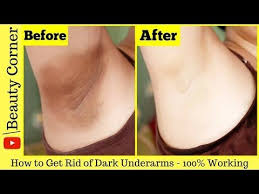 Lighten Dark Underarms Permanently Baking Soda Lemon Lightens Dark U Dark Underarms Baking Soda And Lemon Lighten Armpits