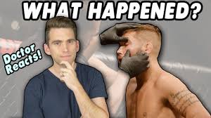 The super fights will broadcast the first two fights of ufc 260 live video our coverage starts at 19:45. Doctor Reacts To Jeremy Stephens Eye Injury At Ufc Fight Night 159 Youtube