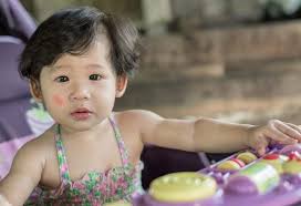 This will naturally enhance his/her skin. Home Remedies To Get Rid Of White Patches On Your Child S Face