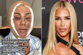 Woman, 66, Lost 110 Pounds and Got a Dramatic Facelift So Shocking, the  Internet Thought It Was Fake (Exclusive)