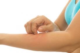 We did not find results for: Dampak Diabetes Pada Kulit Bisa Membuat Kulit Gatal Dan Kering Semua Halaman Grid Health