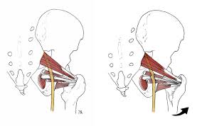 Image result for Obturator Nerve Compression