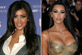 Kim kardashian at the living room surfrider party in 2006. 28 Celebs Who Look Shockingly Different After Plastic Surgery Closer