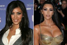 See more ideas about kim kardashian before, kardashian, kim kardashian. 28 Celebs Who Look Shockingly Different After Plastic Surgery Closer