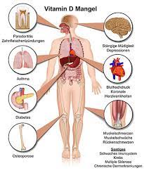 Vitamin D Mangel Ursachen Symptome Behandlung Medlexi De