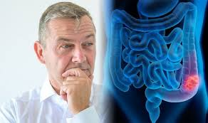 Colorectal cancer, also called colon cancer or large bowel cancer, includes cancerous symptoms. Bowel Cancer Symptoms The Signs Of The Disease To Look Out For When You Go To The Toilet Sound Health And Lasting Wealth