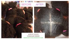 Benefits of apple cider vinegar hair rinse. Benefits Of Using Apple Cider Vinegar On Your Child S Natural Hair Natural Hair Kids