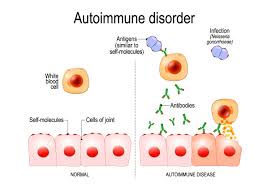 The Basics Of Autoimmune Disease Arthritis Research Arthritis National Research Foundation