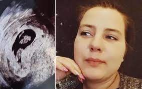 Sarafina freut sich auf ihre zwillinge. Sarafina Wollny Die Zwillinge Sind Da Not Op In Woche 30