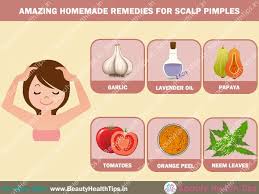 An itchy scalp links to hair loss in several different ways. Homemade Remedies For Scalp Pimples