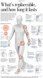 This Is A Very Interesting Infographic What S Replaceable On Your Body And How Long Does It Last Write Som Physical Therapy Massage Therapy Joint Replacement