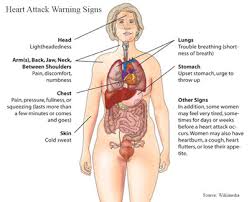 If a person does not receive treatment for a heart attack, it can lead to serious complications. Heart Attack Misdiagnosis Lawyer Nyc Cardiology Malpractice Ny
