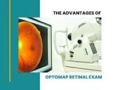 The Advantages of Optomap Retinal Examinations for Your Eye Health