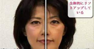 リンパケアの小顔 リフトアップ 顔半分比較 顔 美容 リンパ
