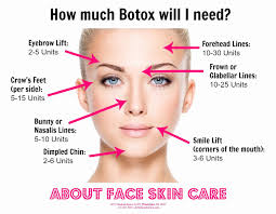 botox injection sites face diagram botox cosmetic