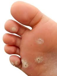 To prevent ingrown hairs, first shave at the end of the shower after applying moisturizing shaving gel to soften the hair. What Is That Skin Growth Skin And Beauty Center Everyday Health