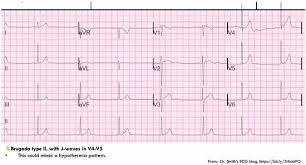 Image result for J Wave