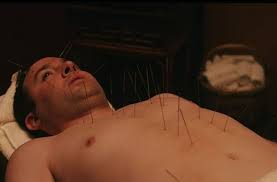 Quand une personne est atteinte de diabète, le pancréas ne sécrète pas suffisamment d'insuline pour répondre aux besoins de son corps, ou le corps ne peut pas utiliser convenablement l'insuline produite. Acupuncture Effet Au Bout De Combien De Temps Et Premiere Seance