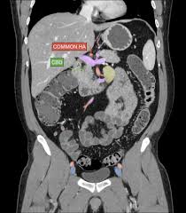 Hint you are sitting on it right now. How To Read A Ct Of The Abdomen And Pelvis Radiology Case Radiopaedia Org