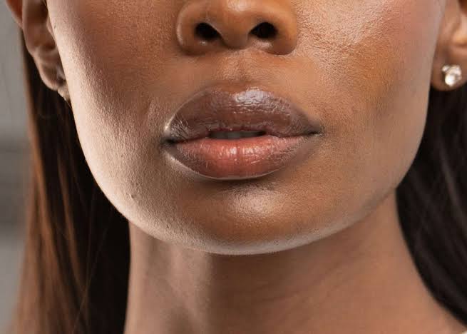 Hyperpigmentation on Lips: Treatment and Prevention