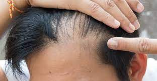 How to spot scalp psoriasis. I Have An Itchy Scalp Do I Have Scalp Psoriasis Orlando Fl Dr Jeannette Hudgens