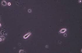 Trichomoniasis Prof Dr Med Werner Mendling