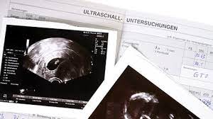 Ab wann bekomme ich den mutterpass? Schwanger Mutterpass Schweiz Babywelten Ch
