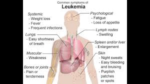 Video Leukemia Is A Group Of Hematologic Malignancy Which Originates From The Hematopoietic System Leukemia Leukemia Symptoms Night Sweats