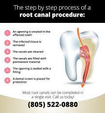 Most Root Canals Can Be Completed In A Single Visit To Our Office But Some May Require Additional Visits Call Us To Schedule A Root Canal Dental Dentistry
