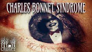 Charles Bonnet Syndrome Youtube
