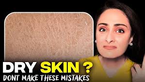 Image result for Dry Skin
