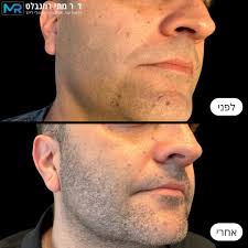 ד"ר מתי רוזנבלט,...