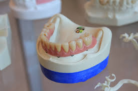 Can you eat a burger with dentures. Tmj Archives Hill Country Oral Surgery