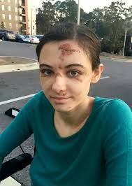 Nursing assistant's horrific injuries after falling from fourth floor