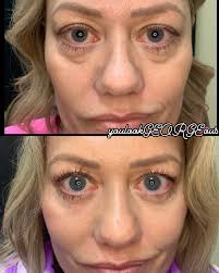 George Salloum, M.D. (@georgesalloummd) · Syracuse, NY