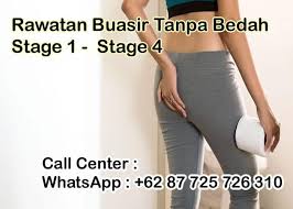 Kami ada 8 cara semulajadi untuk buasir adalah penyakit biasa yang sering dikaitkan dengan ibu hamil tapi ia jarang dibincangkan kerana ia. Pelbagai Cara Ubat Buasir Ketika Hamil Semulajadi Merawat Buasir Punca Buasir Kempiskan Buasir Herba Buasir Ubat Buasir