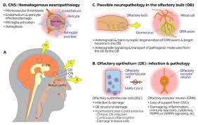 Image result for Drug-Induced Olfactory Dysfunction