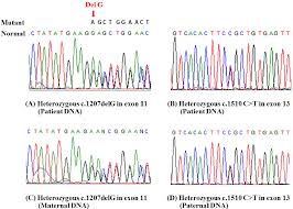 Pdf A Novel Frameshift Mutation Of Hexa Gene In The First Family With Classical Infantile Tay Sachs Disease In Thailand Semantic Scholar