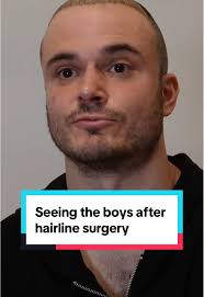 Turkey Hair Plugs Funny