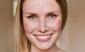 How to reduce redness in face from acne? Facial Redness Visible Vessels How To Reduce Skin Redness