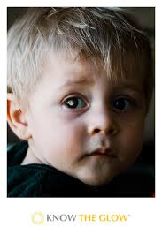 Know The Glow (@Know_The_Glow)