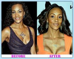 Vivica Fox Plastic Surgery Stories Made Her An Unfair Target Vivica Fox Plastic Surgery Plastic Surgery Before After